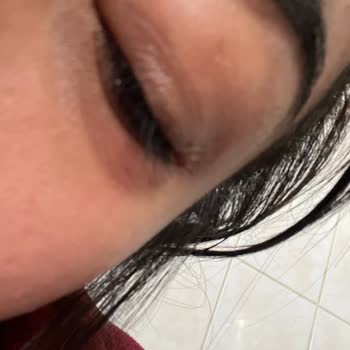 Göz Maskesi Alerjik Reaksiyon Yarattı