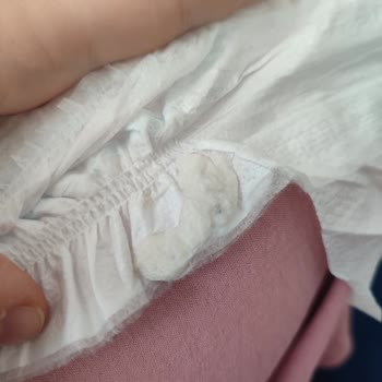 Molfix Bebek Bezinde Hijyen Sorunu
