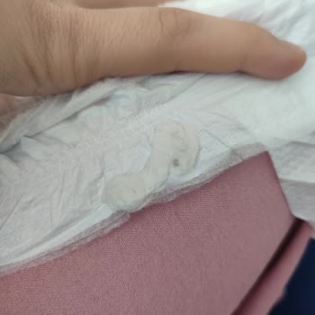 Molfix Bebek Bezinde Hijyen Sorunu