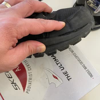 Skechers Ayakkabılarında Hayal Kırıklığı: Kalitesiz Ürün Ve Müşteri Hizmetleri