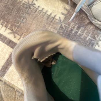 Puma Ayakkabıda Topuk Sorunu Ve Rahatsızlık