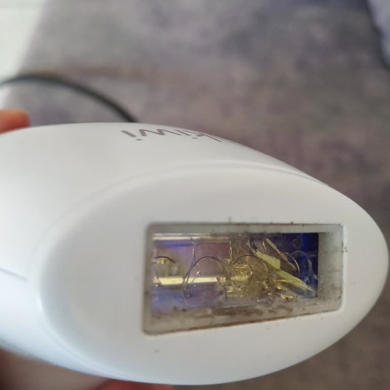 Kiwi Home Lazer Cihazımı Kullanırken Bir Anda Camı Patladı!