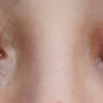 Yves Rocher Göz Altı Serumu Göz Sağlığımı Tehdit Etti!