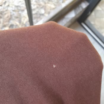 Trendyol'dan Eksik Ürün Ve Haksız İade Reddi