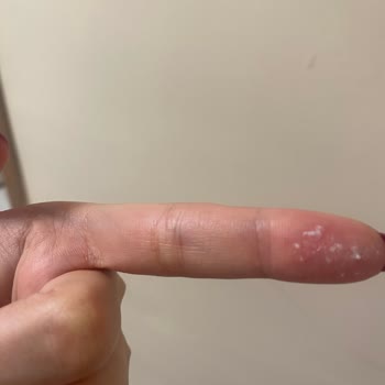 Rexona Ürünü Kıyafetlerde Yağlı İz Bırakıyor