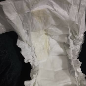 Bebek Bezinde Hijyen Sorunu Ve Yabancı Madde