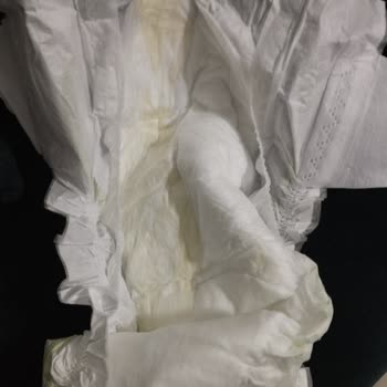 Bebek Bezinde Hijyen Sorunu Ve Yabancı Madde