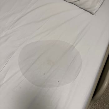 Serumun Yatağa Akması Ve Yüksek Ücret Talebi