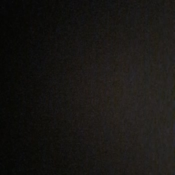 Türk Telekom'un Sürekli İnternet Kesintileri Ve İlgisiz Müşteri Hizmeti