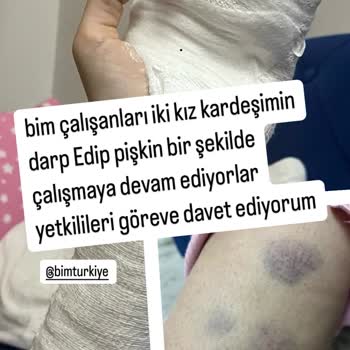 BİM'de Müşteri Darpı Ve Hakaret İddiası