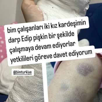 BİM'de Müşteri Darpı Ve Hakaret İddiası