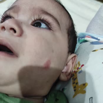 Mustela Bebek Ürünleri Cilt Sorunlarına Yol Açtı