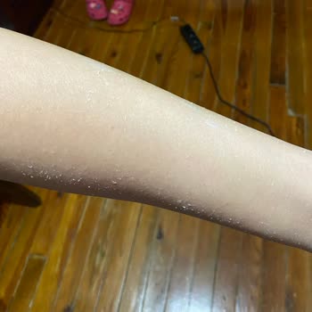 Isana Vücut Losyonu: Emilim Sorunu Ve Ciltte Beyazlık