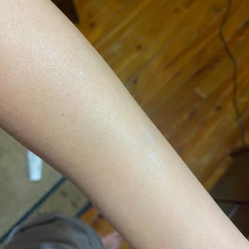 Isana Vücut Losyonu: Emilim Sorunu Ve Ciltte Beyazlık