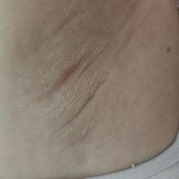 Yves Rocher Deodorant Cildimi Mahvetti