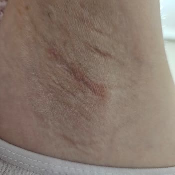 Yves Rocher Deodorant Cildimi Mahvetti