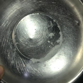 Bebek Bezinde Şaşırtıcı Yabancı Madde