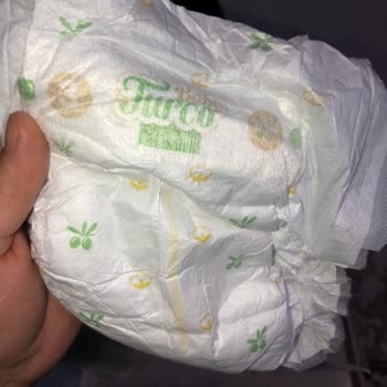 Bebek Bezinde Şaşırtıcı Yabancı Madde