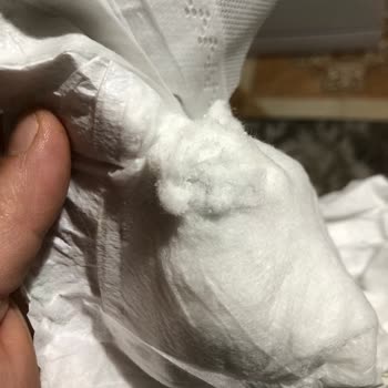 Bebek Bezinde Şaşırtıcı Yabancı Madde