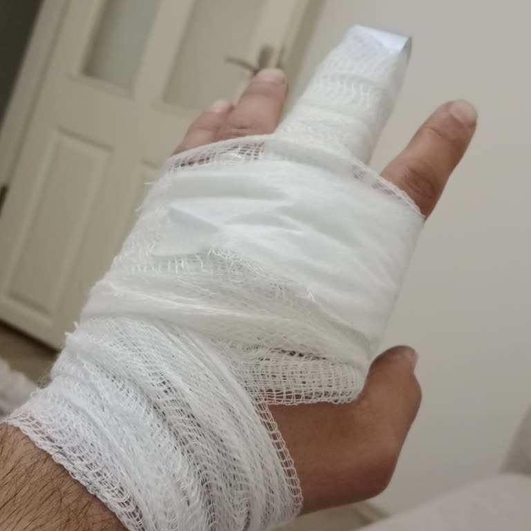 SGK İş Kazası Sonrası Maaş Sorunu