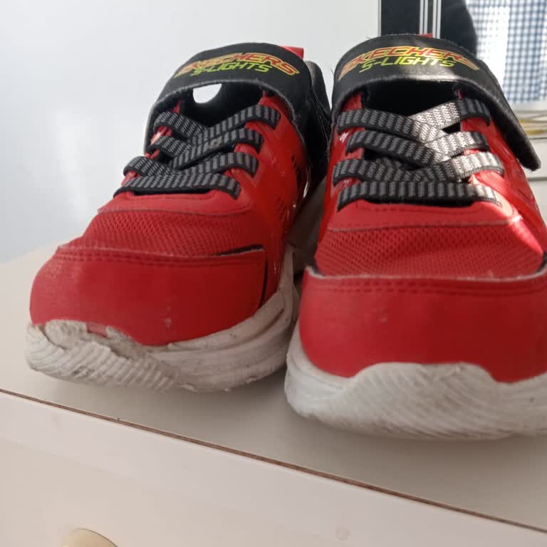 Skechers Ayakkabının Hızla Deforme Olması Ve Mağaza İade Sürecindeki Sorunlar