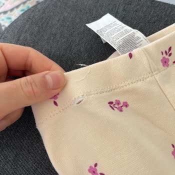 Yeni Alınan Bebek Ürününde Beklenmedik Hasar