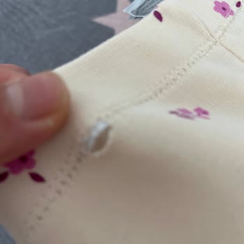 Yeni Alınan Bebek Ürününde Beklenmedik Hasar