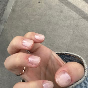 Acılı Manikür Ve İlgisiz Hizmet Deneyimi