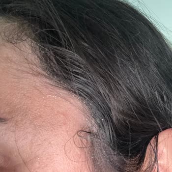 C Vitamini Serumu Hayal Kırıklığı