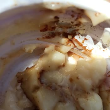 Kazandibinde Hijyen Sorunu: Migros Ürününde Kıl Parçası