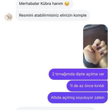 Protez Tırnakta Hayal Kırıklığı: Kısa Sürede Soyulma Ve İlgisiz Müşteri Hizmetleri
