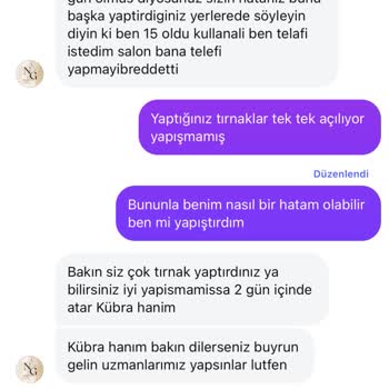 Protez Tırnakta Hayal Kırıklığı: Kısa Sürede Soyulma Ve İlgisiz Müşteri Hizmetleri