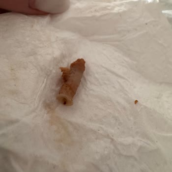 Köroğlu Pide Kebap Lahmacunun İçinden Plastik Gibi Bir Madde Çıktı