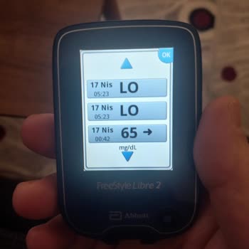 Freestyle Libre Sensör Ölçüm Sorunu