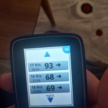 Freestyle Libre Sensör Ölçüm Sorunu