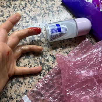 Kırık Ürün Ve Yetersiz Paketleme Sorunu