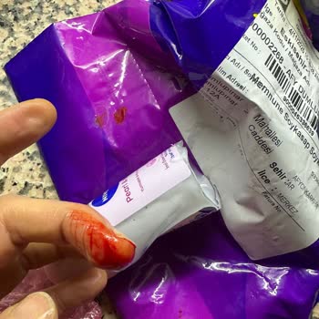 Kırık Ürün Ve Yetersiz Paketleme Sorunu