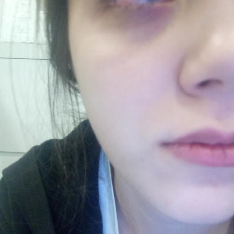 Alerji Yapan Göz Kalemi Sorunu