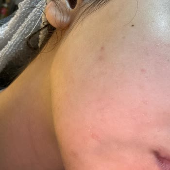 Celenes Temizleme Suyu İle Hayal Kırıklığı