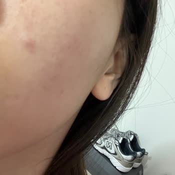 Yves Rocher Doğal İçerikli Krem Hayal Kırıklığı Yarattı