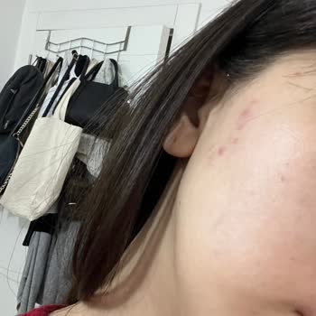 Yves Rocher Doğal İçerikli Krem Hayal Kırıklığı Yarattı