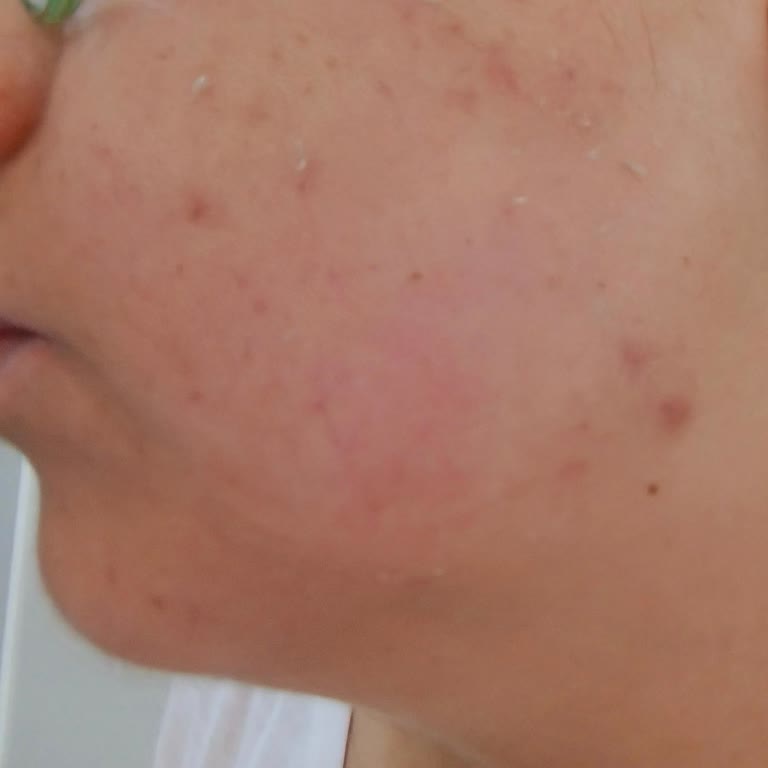 Bioderma Nemlendirici Krem Cildimde Emilmiyor