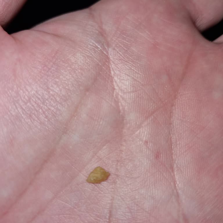 Tadım Gofretin İçinden Çıkan Tehlike