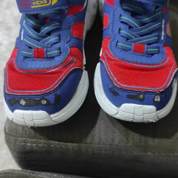 Skechers Ayakkabılarında Beklenmedik Hızda Deformasyon