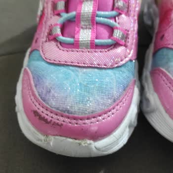 Skechers Ayakkabılarında Beklenmedik Hızda Deformasyon