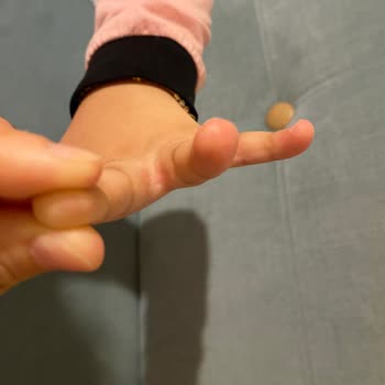 Dalin Köpük Sabun Kullanımı Sonrası Ciddi Alerjik Reaksiyonlar