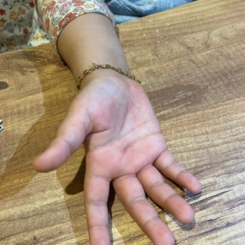 Dalin Köpük Sabun Kullanımı Sonrası Ciddi Alerjik Reaksiyonlar