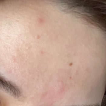 Missha Güneş Kremi Cildimi Mahvetti, Para İadesi İstiyorum