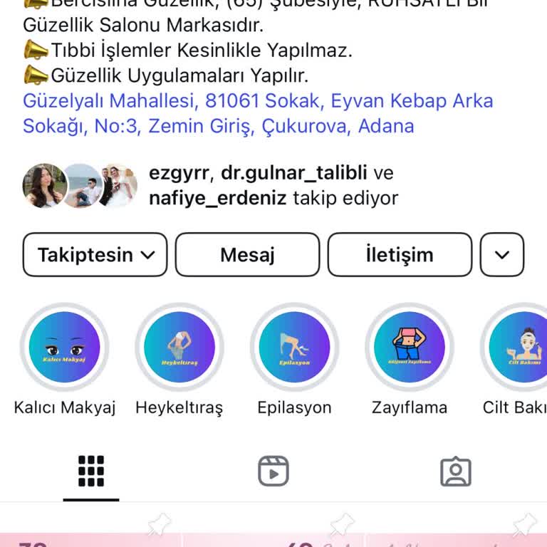 Lazer Paketinde Zaman Aşımı Sorunu