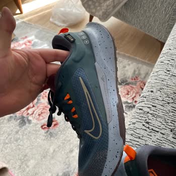 Ayakkabı Kullanımı Sonrası Ciddi Ayak Sorunları